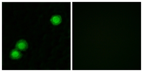 Immunofluorescence of MCF7 cells, using IPKB Antibody. The picture on the right is treated with the synthesized peptide.