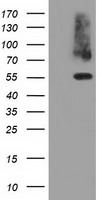 HEK293T cells were transfected with the pCMV6-ENTRY control (Left lane) or pCMV6-ENTRY PKLR (Right lane) cDNA for 48 hrs and lysed. Equivalent amounts of cell lysates (5 ug per lane) were separated by SDS-PAGE and immunoblotted with anti-PKLR.