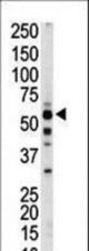 The anti-PKLR antibody is used in Western blot to detect PKLR in mouse liver tissue lysate.