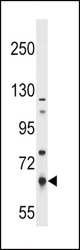 PKLR Antibody (S8) western blot of NCI-H292 cell line lysates (35 ug/lane). The PKLR antibody detected the PKLR protein (arrow).