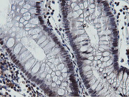 IHC of paraffin-embedded Human colon tissue using anti-MIPEP mouse monoclonal antibody.