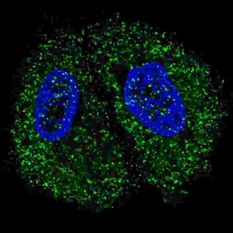 Fluorescent confocal image of MCF7 cells stained with Pyruvate Kinase (PKM2) antibody. MCF7 cells were fixed with 4% PFA (20 min), permeabilized with Triton X-100 (0.2%, 30 min). Cells were then incubated Pyruvate Kinase (PKM2) primary antibody (1:200, 2 h at room temperature). For secondary antibody, Alexa Fluor 488 conjugated donkey anti-rabbit antibody (green) was used (1:1000, 1h). Nuclei were counterstained with Hoechst 33342 (blue) (10 ug/ml, 5 min). Note the highly specific localization of the Pyruvate Kinase (PKM2) mainly to the cytoplasm, supported by Human Protein Atlas Data (http://www.proteinatlas.org/ENSG00000067225).