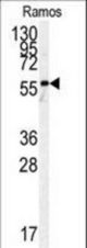 Western blot of anti-h PKM2-N491 antibody in Ramos cell line lysates (35 ug/lane). hPKM2-N491(arrow) was detected using the purified antibody.