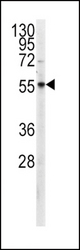 Western blot of anti-PKM2 Antibody (C-term C474) in CEM cell line lysates (35 ug/lane). PKM2(arrow) was detected using the purified antibody.
