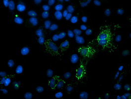 Anti-MIPEP mouse monoclonal antibody immunofluorescent staining of COS7 cells transiently transfected by pCMV6-ENTRY MIPEP.