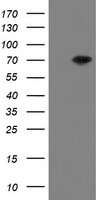 HEK293T cells were transfected with the pCMV6-ENTRY control (Left lane) or pCMV6-ENTRY MIPEP (Right lane) cDNA for 48 hrs and lysed. Equivalent amounts of cell lysates (5 ug per lane) were separated by SDS-PAGE and immunoblotted with anti-MIPEP.