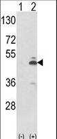 Western blot of PKM2 (arrow) using rabbit polyclonal PKM2 Antibody (N-term E131). 293 cell lysates (2 ug/lane) either nontransfected (Lane 1) or transiently transfected with the PKM2 gene (Lane 2).