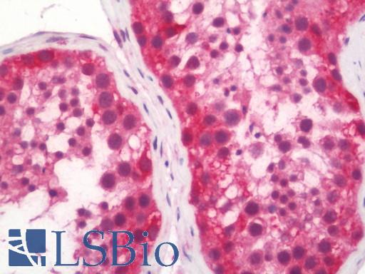 Human Testis: Formalin-Fixed, Paraffin-Embedded (FFPE)