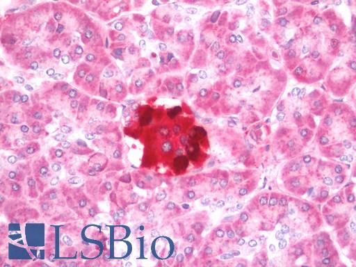 Human Pancreas: Formalin-Fixed, Paraffin-Embedded (FFPE)
