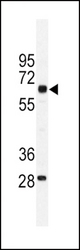 Western blot of PKM1 antibody (C-term L398) in mouse testis tissue lysates (35 ug/lane). PKM1 (arrow) was detected using the purified antibody.