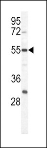 Western blot of PKM1 antibody (C-term L398) in HeLa cell line lysates (35 ug/lane). PKM1 (arrow) was detected using the purified antibody.