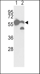 Western blot of hPKM2-N491 in A2058 cell line(lane 1) and mouse brain tissue(lane 2) lysates (35 ug/lane). PKM2 (arrow) was detected using the purified antibody.