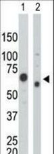 The anti-PKM2 antibody is used in Western blot to detect PKM2 in HeLa cell lysate (Lane 1) and 3T3 cell lysate (Lane 2).