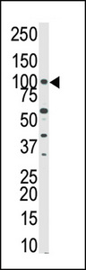Western blot of anti-PKN-beta antibody in HeLa cell lysate. PKNbeta (arrow) was detected using purified antibody. Secondary HRP-anti-rabbit was used for signal visualization with chemiluminescence.