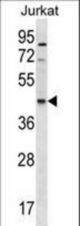 GDE1 Antibody western blot of Jurkat cell line lysates (35 ug/lane). The GDE1 antibody detected the GDE1 protein (arrow).