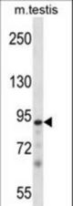 Mouse Pkn3 Antibody western blot of mouse testis tissue lysates (35 ug/lane). The Pkn3 antibody detected the Pkn3 protein (arrow).