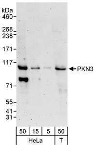 Detection of Human PKN3 by Western Blot. Samples: Whole cell lysate from HeLa (5, 15 and 50 ug) and 293T (T; 50 ug) cells. Antibodies: Affinity purified rabbit anti-PKN3 antibody used for WB at 0.1 ug/ml. Detection: Chemiluminescence with an exposure time of 30 seconds.