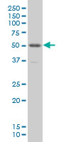 PKNOX1 monoclonal antibody (M01), clone 4F6 Western Blot analysis of PKNOX1 expression in IMR-32.