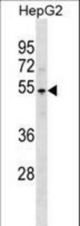PKNOX1 Antibody western blot of HepG2 cell line lysates (35 ug/lane). The PKNOX1 antibody detected the PKNOX1 protein (arrow).