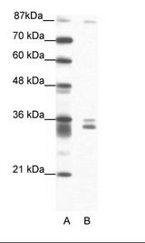 A: Marker, B: Jurkat Cell Lysate