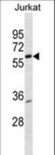 PKNOX2 Antibody western blot of Jurkat cell line lysates (35 ug/lane). The PKNOX2 Antibody detected the PKNOX2 protein (arrow).