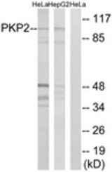 Western blot of extracts from HeLa/HepG2 cells, using PKP2 Antibody. The lane on the right is treated with the synthesized peptide.