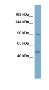PKP2 / Plakophilin 2 antibody LS-C107909 Western blot of COLO205 cell lysate.