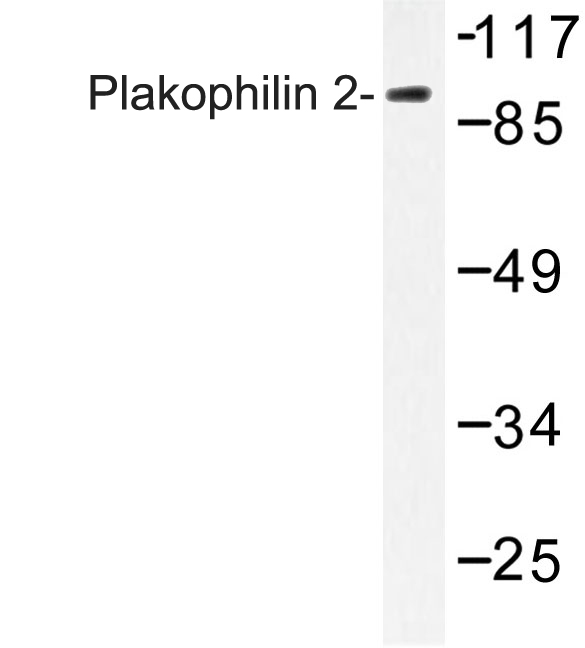 Western blot of Plakophilin 2 (P663) pAb in extracts from HeLa cells.