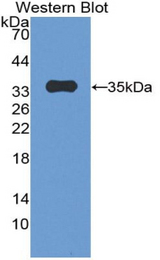 Western blot of recombinant PKP2 / Plakophilin 2.