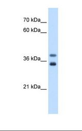 Jurkat cell lysate. Antibody concentration: 0.5 ug/ml. Gel concentration: 12%.
