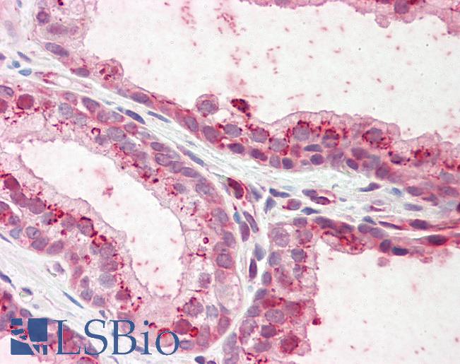 Anti-PKP2 / Plakophilin 2 antibody IHC staining of human prostate. Immunohistochemistry of formalin-fixed, paraffin-embedded tissue after heat-induced antigen retrieval.