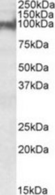 PKP2 antibody (0.3 ug/ml) staining of Mouse Heart lysate (35 ug protein/ml in RIPA buffer). Primary incubation was 1 hour. Detected by chemiluminescence.