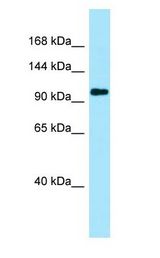 PKP4 / Plakophilin 4 antibody Western Blot of HeLa.
