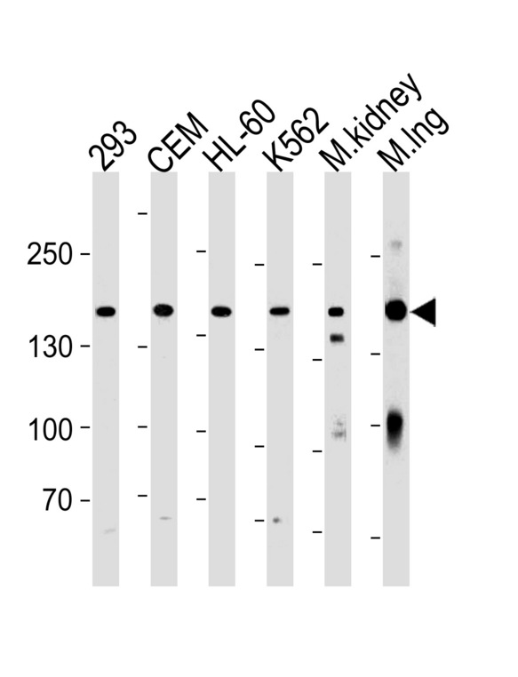 PKP4 Antibody western blot of 293,CEM,HL-60,K562 cell line and mouse kidney,lung tissue lysates (35 ug/lane). The PKP4 antibody detected the PKP4 protein (arrow).