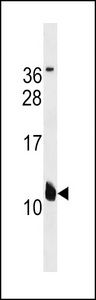 KCNE2 Antibody western blot of A549 cell line lysates (35 ug/lane). The KCNE2 antibody detected the KCNE2 protein (arrow).