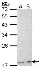Sample (30 ug of whole cell lysate). A: H1299, B: Hela. 12% SDS PAGE. PLA2G12A antibody diluted at 1:1000.