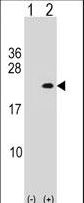 Western blot of PLA2G12A (arrow) using rabbit polyclonal PLA2G12A Antibody. 293 cell lysates (2 ug/lane) either nontransfected (Lane 1) or transiently transfected (Lane 2) with the PLA2G12A gene.
