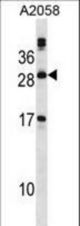 PLA2G12A Antibody western blot of A2058 cell line lysates (35 ug/lane). The PLA2G12A antibody detected the PLA2G12A protein (arrow).