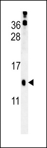 HRASLS3 Antibody western blot of mouse kidney tissue lysates (15 ug/lane). The HRASLS3 antibody detected HRASLS3 protein (arrow).