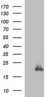 HEK293T cells were transfected with the pCMV6-ENTRY control (Left lane) or pCMV6-ENTRY PLA2G16 (Right lane) cDNA for 48 hrs and lysed. Equivalent amounts of cell lysates (5 ug per lane) were separated by SDS-PAGE and immunoblotted with anti-PLA2G16.