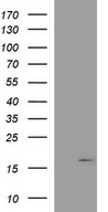 HEK293T cells were transfected with the pCMV6-ENTRY control (Left lane) or pCMV6-ENTRY PLA2G16 (Right lane) cDNA for 48 hrs and lysed. Equivalent amounts of cell lysates (5 ug per lane) were separated by SDS-PAGE and immunoblotted with anti-PLA2G16.