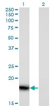 Western blot of PLA2G16 expression in transfected 293T cell line by PLA2G16 monoclonal antibody (M02), clone 4C4-2A11.