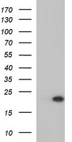 HEK293T cells were transfected with the pCMV6-ENTRY control (Left lane) or pCMV6-ENTRY PLA2G16 (Right lane) cDNA for 48 hrs and lysed. Equivalent amounts of cell lysates (5 ug per lane) were separated by SDS-PAGE and immunoblotted with anti-PLA2G16.