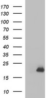 HEK293T cells were transfected with the pCMV6-ENTRY control (Left lane) or pCMV6-ENTRY PLA2G16 (Right lane) cDNA for 48 hrs and lysed. Equivalent amounts of cell lysates (5 ug per lane) were separated by SDS-PAGE and immunoblotted with anti-PLA2G16.