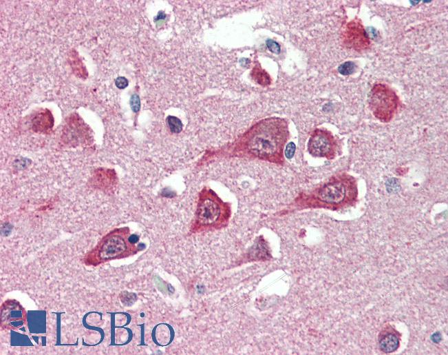 Anti-PLA2G16 antibody IHC of human brain, cortex. Immunohistochemistry of formalin-fixed, paraffin-embedded tissue after heat-induced antigen retrieval. Antibody LS-B3287 concentration 5 ug/ml.