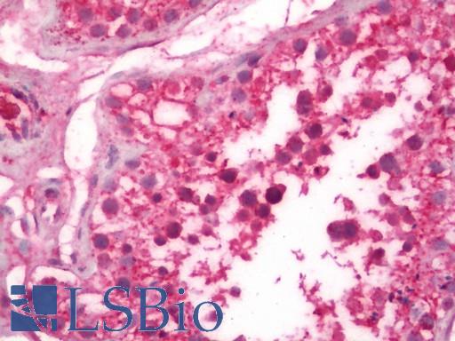 Human Testis: Formalin-Fixed, Paraffin-Embedded (FFPE)