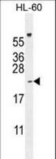 PLA2G2C Antibody western blot of HL-60 cell line lysates (35 ug/lane). The PLA2G2C antibody detected the PLA2G2C protein (arrow).