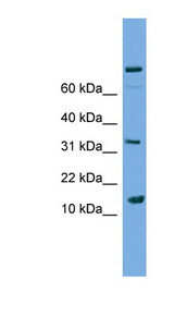 PLA2G2E antibody LS-C117176 Western blot of Jurkat lysate.