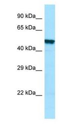 PLA2G3 antibody Western Blot of HT1080.