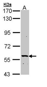Sample (30 ug of whole cell lysate). A: Molt-4 . 7.5% SDS PAGE. PLA2G3 antibody diluted at 1:1000.